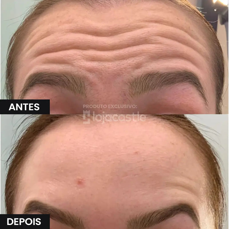 Creme Antirrugas Instantâneo